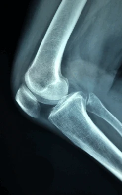 GlucoXtra 180 - New Optimized Formula !